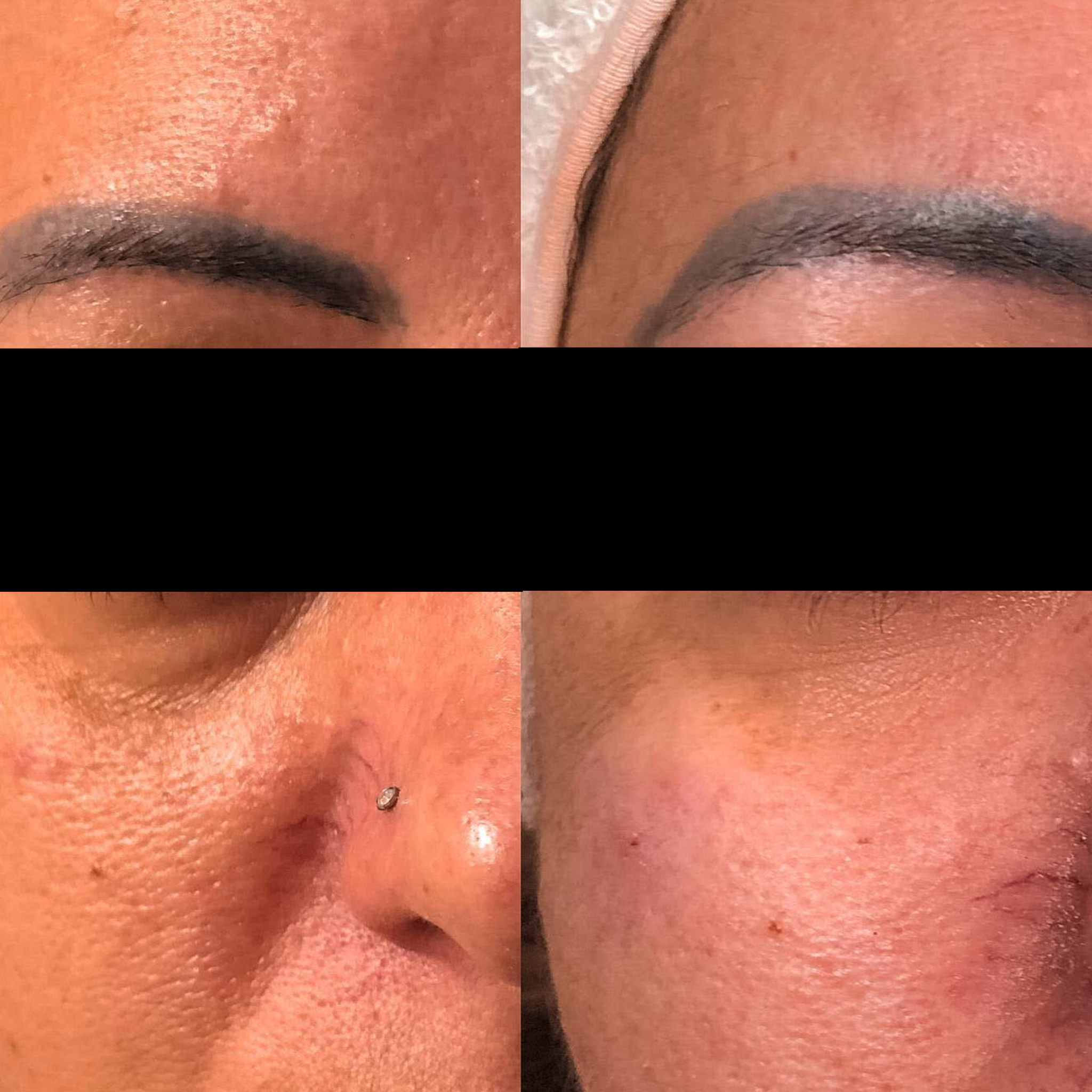 Preenchimento de Olheira