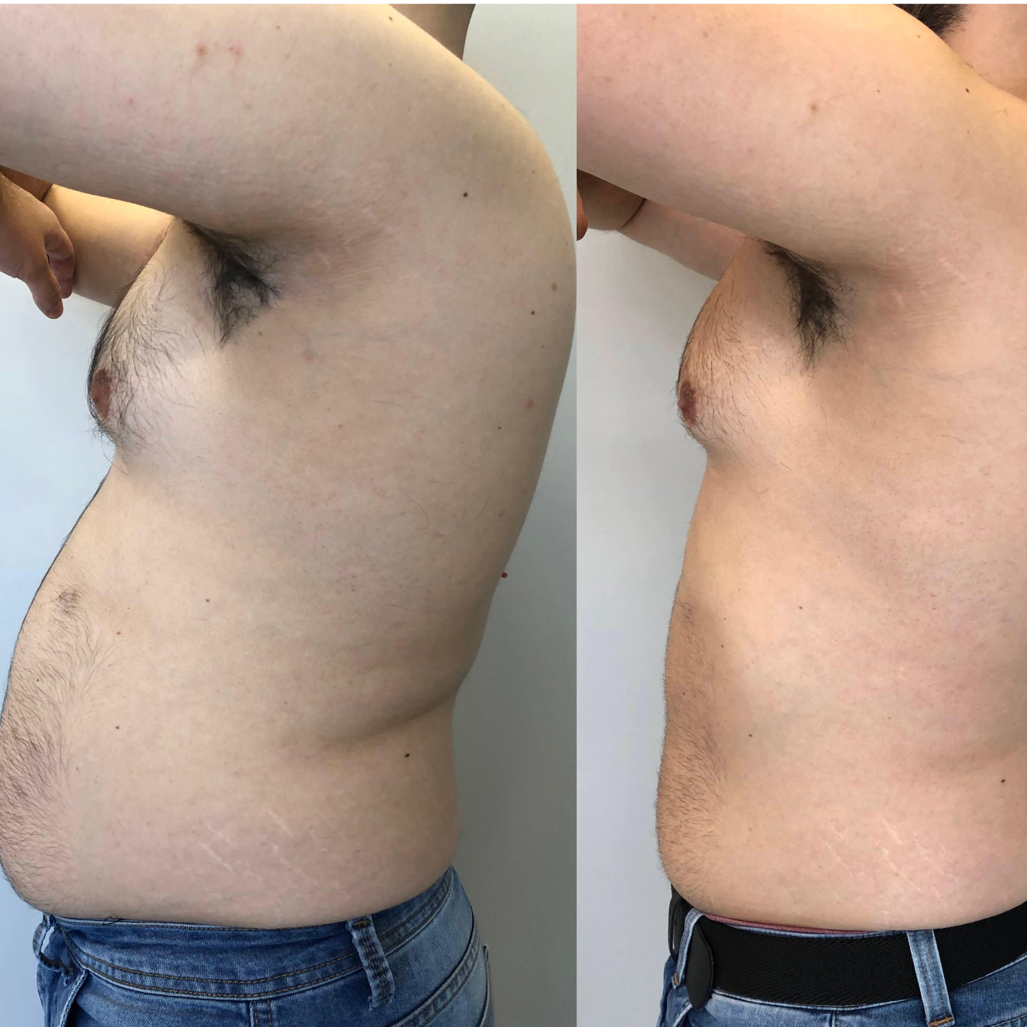 Tratamentos Corporais